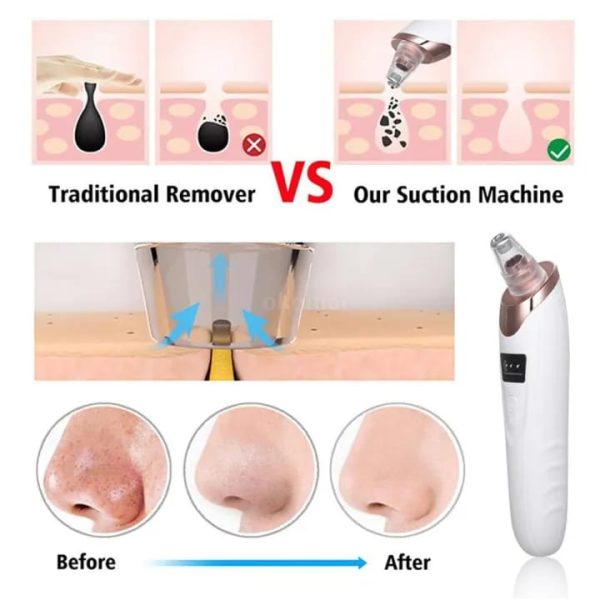 Blackhead Remover Pore Cleaner Vacuum Suction